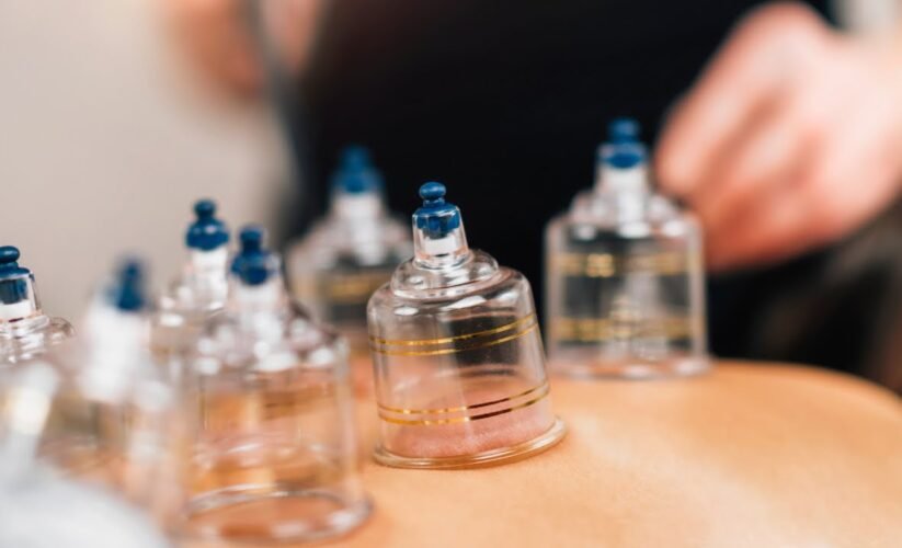 📚 Guide Complet sur la Hijama : Santé, Bien-être & Médecine Prophétique