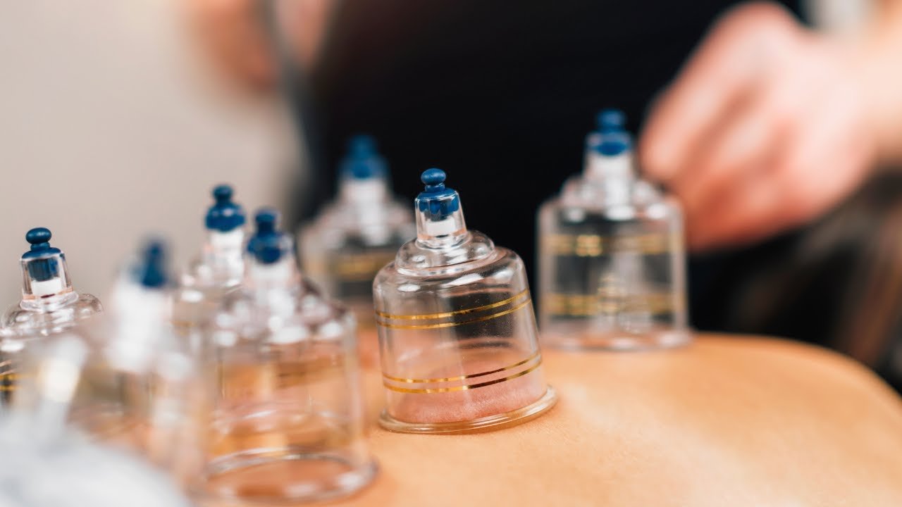 📚 Guide Complet sur la Hijama : Santé, Bien-être & Médecine Prophétique